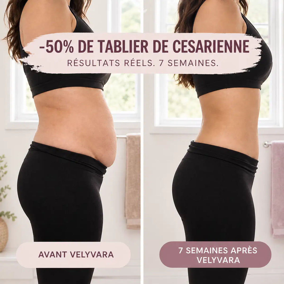 Culotte Post-Partum — Compression 360°