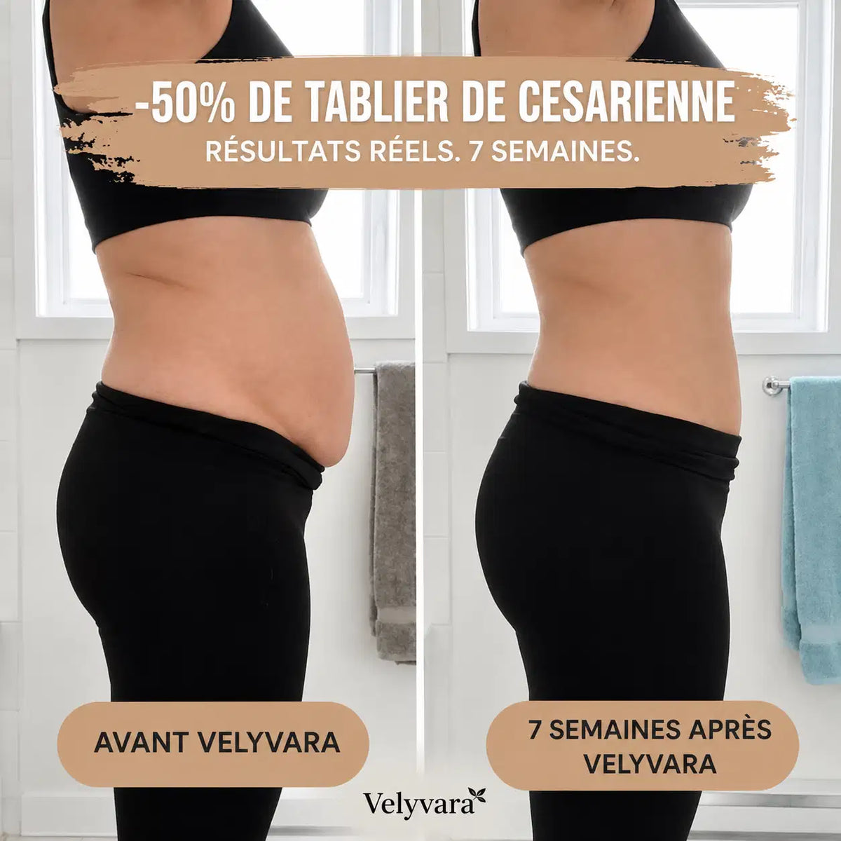 Culotte Post-Partum — Compression 360°